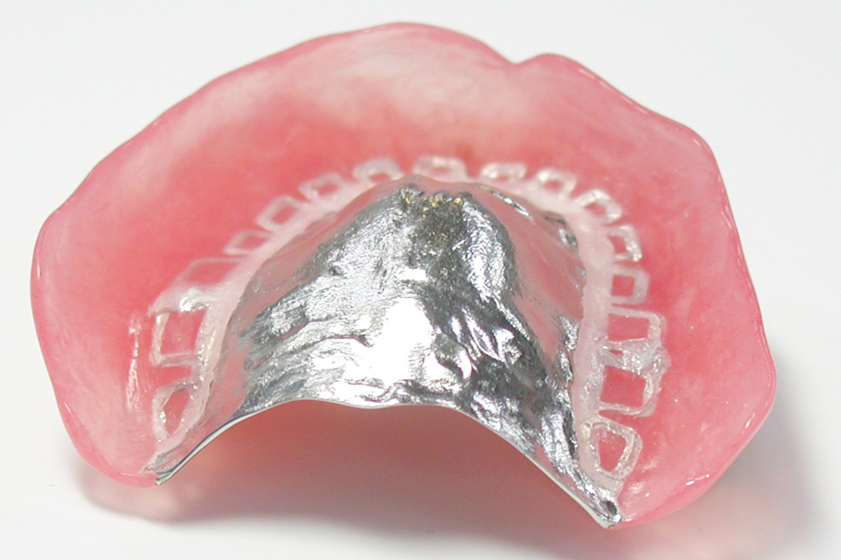 当院で扱う入れ歯に用いる素材 金属床義歯