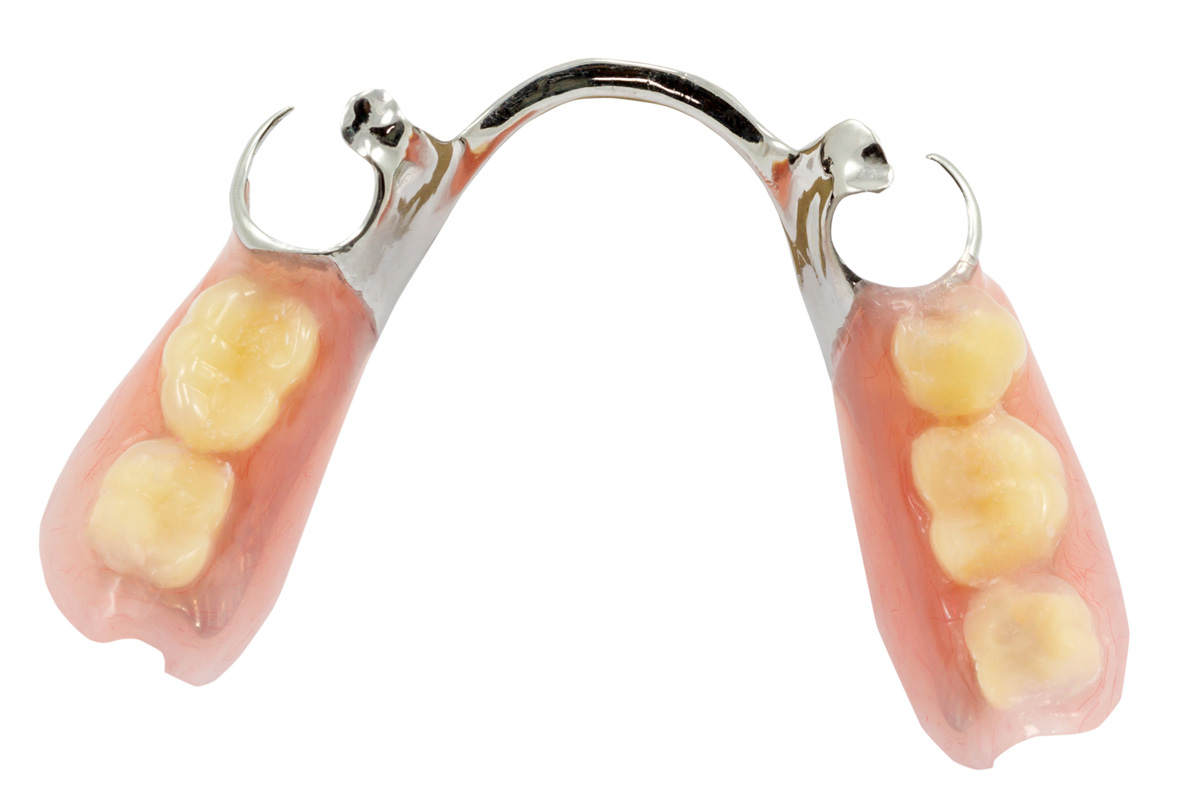 当院で扱う入れ歯に用いる素材 レジン床義歯